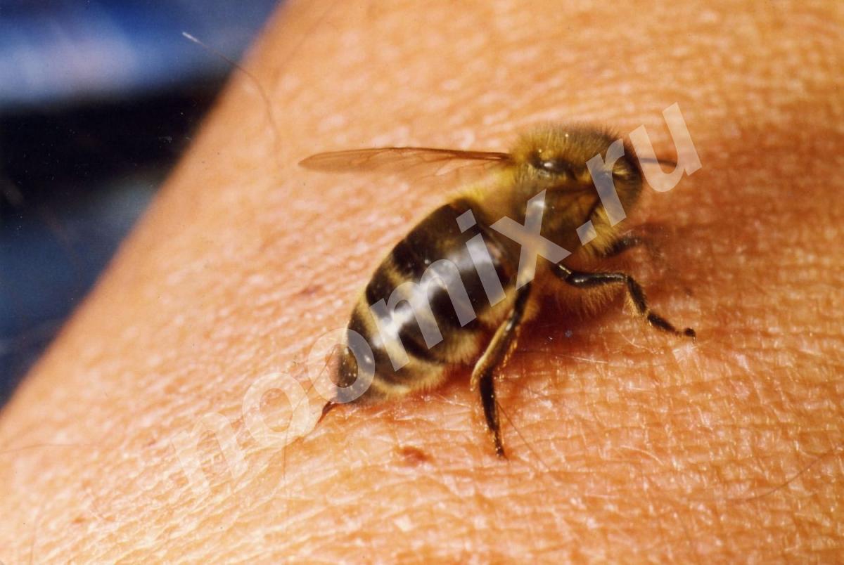 Лечение пчелами пчелинным ядом непосредственно ..., Алтайский край