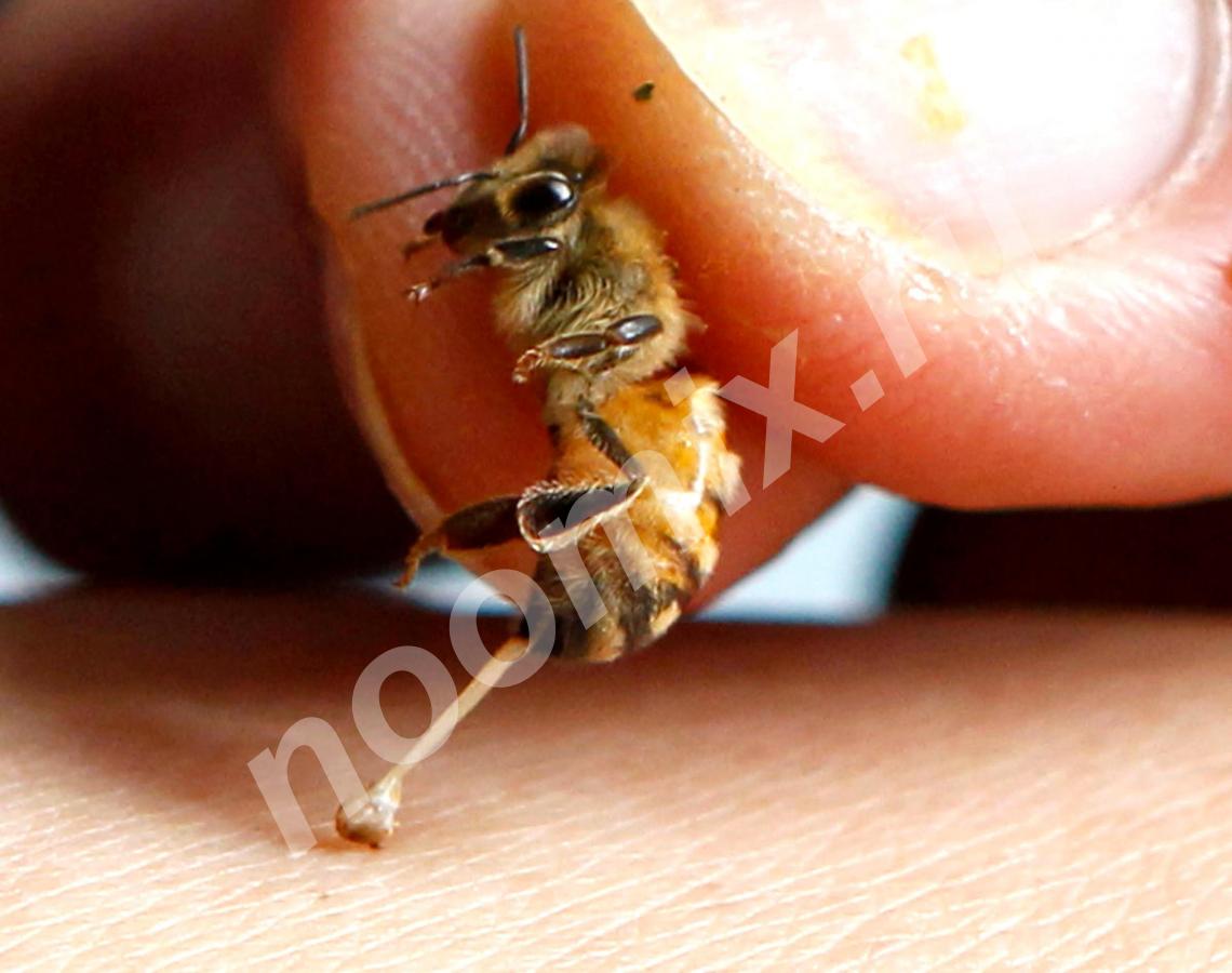 Лечение пчелами апитерапия